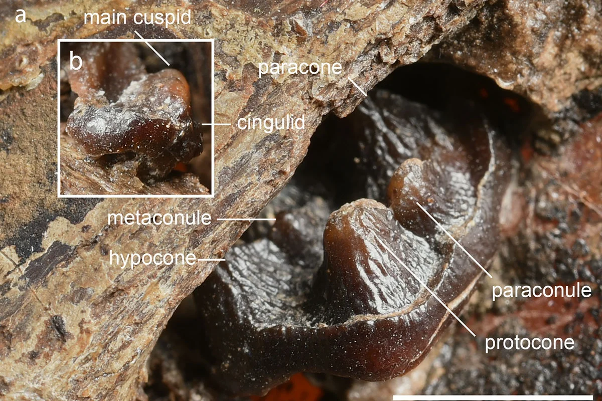 Fetal teeth